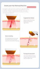 Aparat Epilare Definitiva Laser Dioda 3Lungimi 755NM, 808NM, 1064NM Profesional 1000W Dioda Laser, 50mil Impulsuri DERMASkin Black