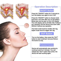 Aparat Plasma pen Indepartarea Petelor, Alunitelor, Pistruilor, Ecran LCD, Antiacnee 1 Mole Removal, Floral Gold