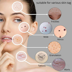 Aparat Plasma pen Indepartarea Petelor, Alunitelor, Pistruilor, Ecran LCD, Antiacnee 1 Mole Removal, Floral Gold