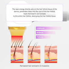 Aparat Epilare Definitiva Laser Dioda 3Lungimi 755NM, 808NM, 1064NM Profesional 1000W Dioda Laser, 50mil Impulsuri DERMASkin Black
