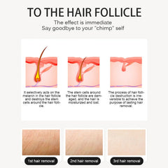 Aparat 2in1 DUO Epilare Definitiva Laser Dioda 3Lungimi 755NM, 808NM, 1064NM Profesional 1200W Dioda Laser, 50mil Impulsuri DERMASkin + PICO Laser Gold