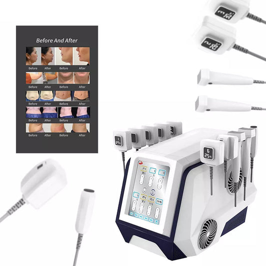 Aparat de Lipoliza Radiofrecventa Monopolara 2MHz, Pierdere Greutate Localizata, Conturare, Reducerea Celulitei, Intinerirea Pielii, Fermitate TRUBODY