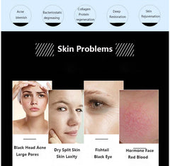 Aparat MASCA SPA terapie cu lumină PDT LED, Face Lift, SPA Face LED PDT, Tratament pentru acnee, Întinerirea pielii fetei,