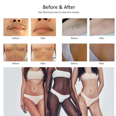 Aparat Epilare Definitiva Laser Dioda 3Lungimi 755nm, 808nm, 1064nm Profesional 1600W Dioda Laser, 50mil Impulsuri Manipul Touch Screen + PICO Laser AVANTSKIN