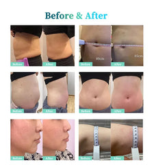 Aparat Profesional 5 Manipuli Criolipoliza 360 DEEPCool,Cryoterapie Indepartare celulita, Fat Freezing Lifting Salon, DEEPSCULPTURE Black