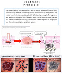 Aparat Laser PicoSecond Profesional 1MILION Impulsuri, Indepartare Tatuaje Negre|Color, Pete Pigmentare, Skin Rejuvenation, Carbon Peel MiniPICO