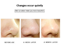 Aparat Cosmetic Skin Scrubber Peeling Exfoliator Facial, Multi-Functional Face Lifting Beauty Machine, Pink, Perfect