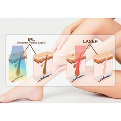 Aparat 2in1 Epilare Definitiva Ice Platinium OPT IPL SHR E-light + Rejuvenare Faciala 300Mii Impulsuri, Epilare Laser Profesionala Salon Oplall