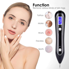Aparat Plasma Indepartarea Petelor, Alunitelor, Pistruilor, Papiloamelor Ecran LCD, Antiacnee 1 Mole Removal, Floral Black