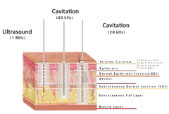 Aparat Remodelare Corporala LCD 3in1 40Khz Cavitatie in vid, Vacuum RF, Tonifiere, Slabire in greutate, Indepartare celulita, Slabire Rapida, Radiofrecventa Profesional Salon LA103