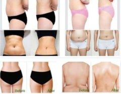 Aparat Ultrasunete Plutonix HIFU Tonifiere si Slabire Corp, Indepartarea Celulitei, Intinerirea pielii - Energie cu ultrasunete concentrata la intensitate ridicata Hello Body, Gel Corp Cadou