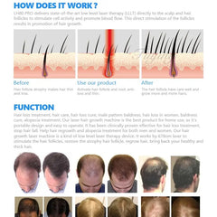 Casca Laser Regenerare capilara, crestere par cu Laser pt Femei, Barbati 80 Diode