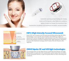 Aparat Ultrasunete Mini HIFU Lifting Facial, Indepartarea Ridurilor, Intinerirea pielii - Energie cu ultrasunete concentrata la intensitate ridicata