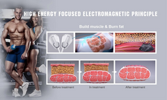 Aparat Electromagnetic Tesla EMS Sculpt HI-EMT si RF Remodelare corporala, Creare Masa Musculara, Tonifiere Abdomen, 2 Manipuli, Slabire intensiva