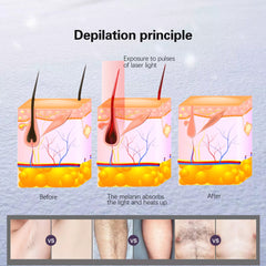 Aparat Epilare Definitiva TotulPerfect Profesional Platinia'S 808nm, 755nm, 1064nm Dioda Laser, 50mil Impulsuri, Epilare Laser Salon 1200W