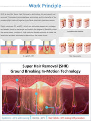 Aparat Epilare Definitiva Laser Dioda 3Lungimi 755, 808, 1064nm Profesional 1200W Dioda Laser, 50mil Impulsuri + PICOSecond Laser