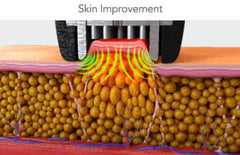 Aparat Vacuum EndoRole Mobile Bi-polar RF EndermoMasaj, IR Laser Profesional Remodelare Corporala, Indepartare Celulita