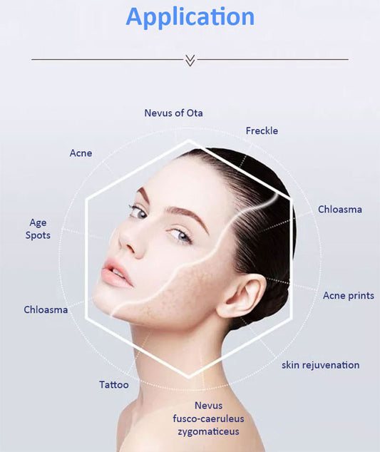 Aparat Laser Q-Switch PICOLaser Profesional 1,000,000 Impulsuri, Indepartare Tatuaje, Micropigmentare, Skin Rejuvenation, Carbon Peel Conrad