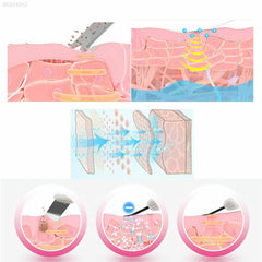 Aparat Cosmetic Skin Scrubber, Peeling Exfoliator Facial, Multi-Functional Face Lifting Beauty Machine, Sky, Perfect