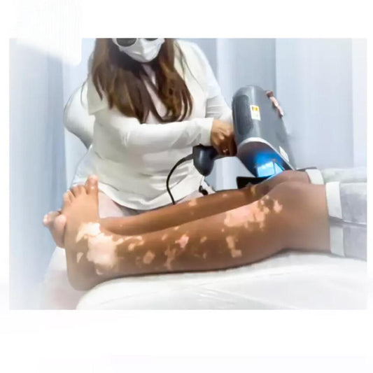 Aparat Tratare Psoriasis, Vitiligo, Herpes, Eczeme, Dermatita Atopica Phototerapie 308nm XeCI, Lampa UVB Profesional XC-D