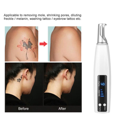 Aparat Indepartare Tatuaje Negre, Laser Lumina Blue Indepartarea Petelor, Alunitelor Pistruilor, Intinerirea pielii Antiacnee FR-100, White